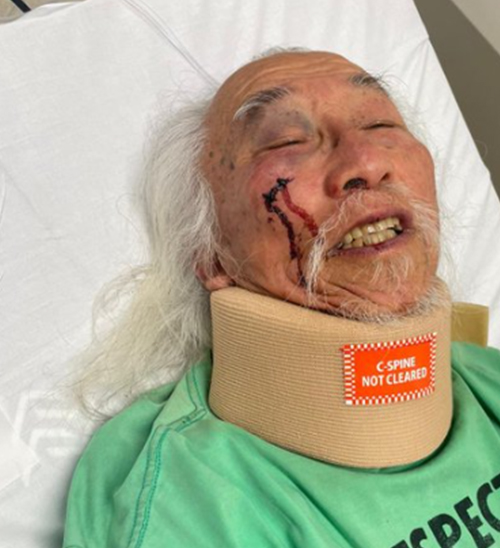 澳华裔老人遭警方暴力执法! 头朝下按地流血送医, 很多华人都见过他…