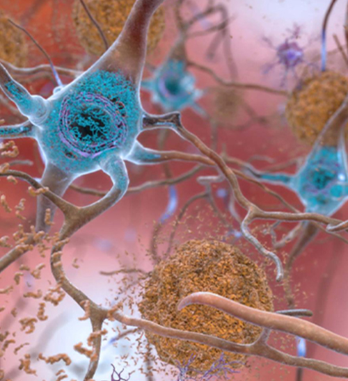 重磅! 最新研究: 只需一个简单动作, 就能清除大脑毒素, 有效预防老年痴呆! 不花钱不吃药