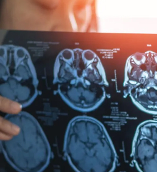 澳洲老年痴呆人数疯长, 没想到干这些职业患病率最低!